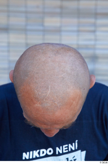 Street  809 bald head 0006.jpg